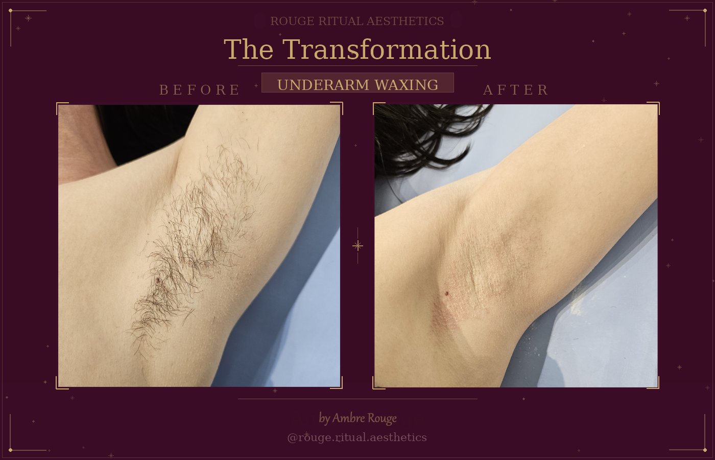Underarm Waxing