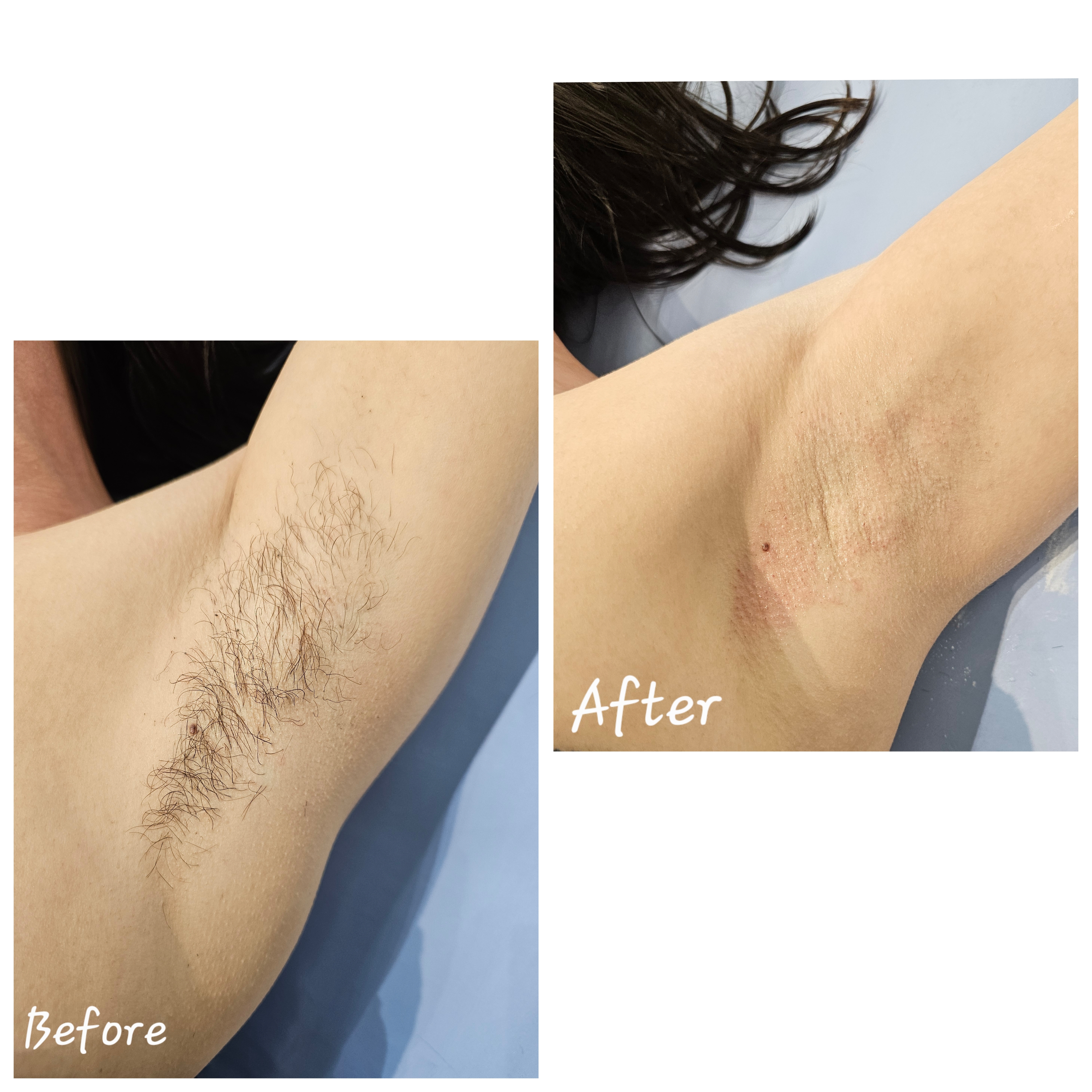 Violet — Underarm Waxing